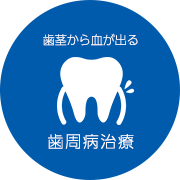 歯茎から血が出る　歯周病治療
